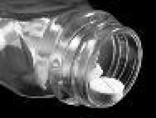 Generika und OTC Arzneimittel in Polen stärker nachgefragt Bild: Generika und OTC Arzneimittel in Polen stärker nachgefragt