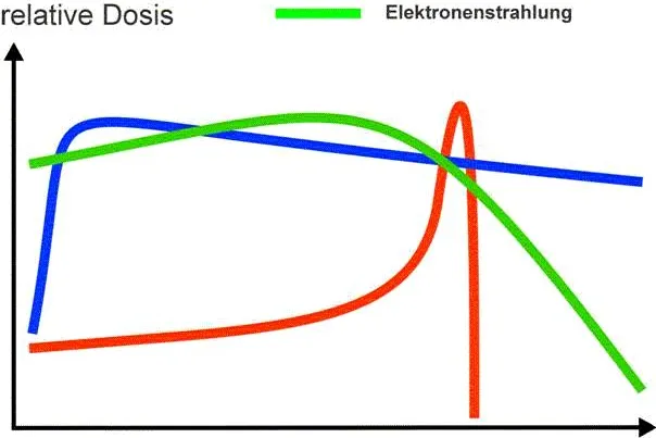 Bild: Protonentherapie, die Behandlung der Zukunft