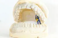Wurzelbehandlung mit dem Dentalmikroskop in der Praxis Prof. Dhom Bild: Wurzelbehandlung mit dem Dentalmikroskop in der Praxis Prof. Dhom