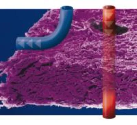 Bild: Zahnmedizin: angiopore – selektiv permeable Membran
