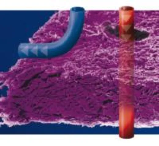 Bild: Zahnmedizin: angiopore – selektiv permeable Membran