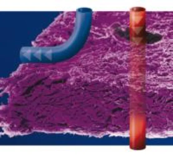Bild: Zahnmedizin: angiopore – selektiv permeable Membran