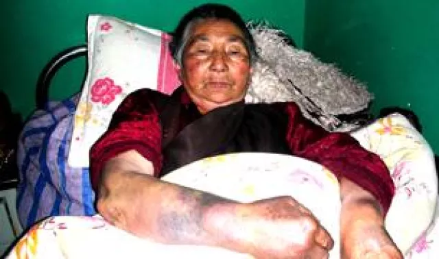 Bild: Zwei durch Folter ruinierte Tibeterinnen in Ngaba aus der Haft entlassen