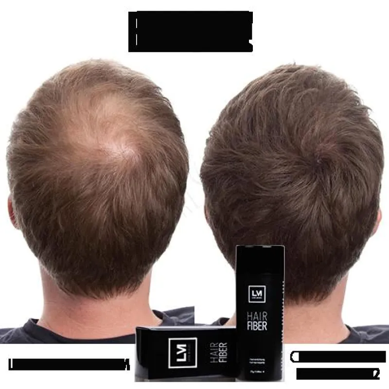 Volle Haare in 30 Sekunden! Ohne Haartransplantation!