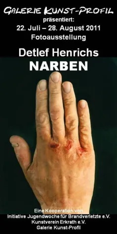 NARBEN - Fotoausstellung von Detlef Henrichs Bild: NARBEN - Fotoausstellung von Detlef Henrichs