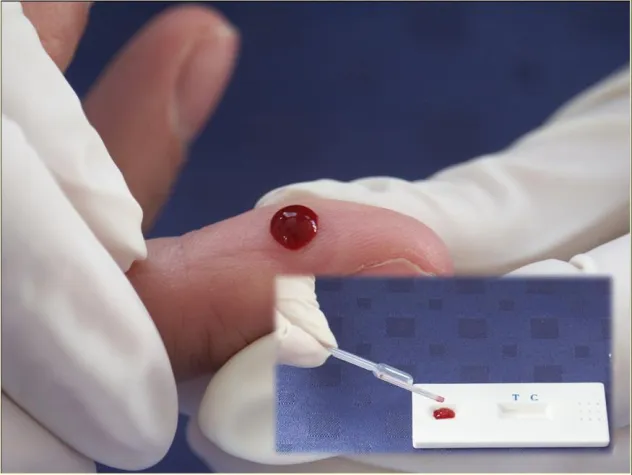 Bild: Tetanus: Neuer Schnelltest schafft Klarheit über Immunstatus