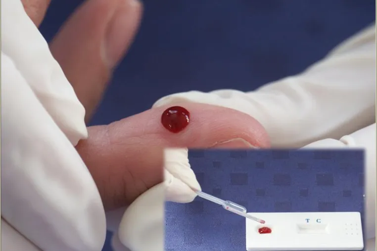 Tetanus: Neuer Schnelltest schafft Klarheit über Immunstatus Bild: Tetanus: Neuer Schnelltest schafft Klarheit über Immunstatus