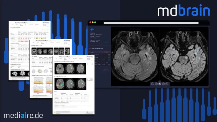 mediaire eröffnet mit Produkt mdbrain 3.0 neue Möglichkeit der Frühdiagnostik von Demenzen Bild: mediaire eröffnet mit Produkt mdbrain 3.0 neue Möglichkeit der Frühdiagnostik von Demenzen