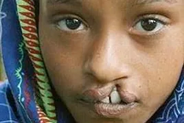 XanGo ermöglicht Kindern das Lachen Bild: XanGo ermöglicht Kindern das Lachen