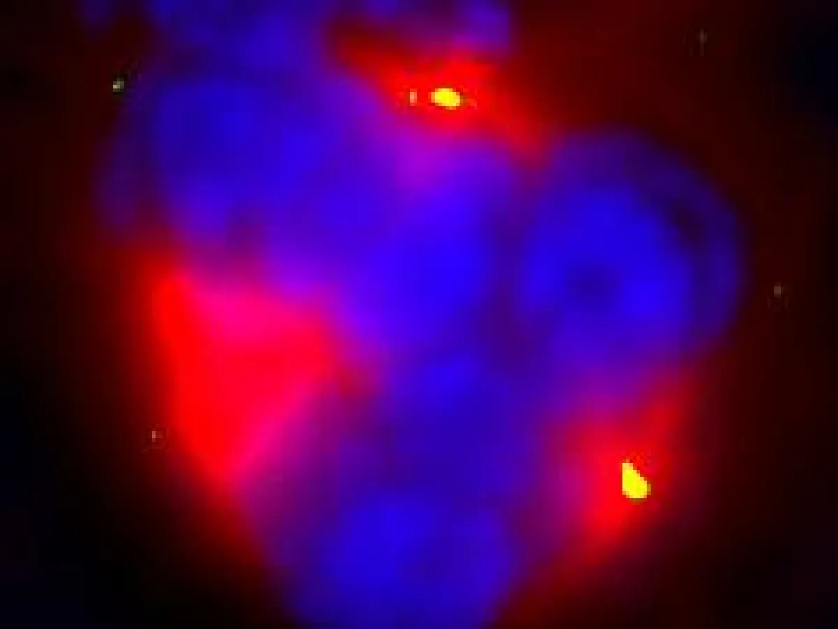 Taxanes induce tripolar instead of normal bipolar cell division. The daughter cells are more sensitive to radiation damage. DNA is stained in blue, tubulin in red and centrosomes in green. (Source: