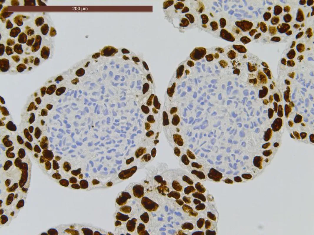 Empa’s multicellular model, which is mimicking the placental barrier: a core of connective tissue cells, surrounded by trophoblast cells. (Empa)