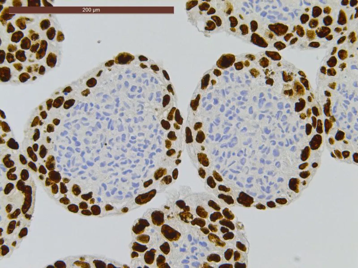 Empa’s multicellular model, which is mimicking the placental barrier: a core of connective tissue cells, surrounded by trophoblast cells. (Empa)