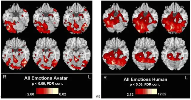 Bild: Das Gehirn vom Informationsmüll befreien