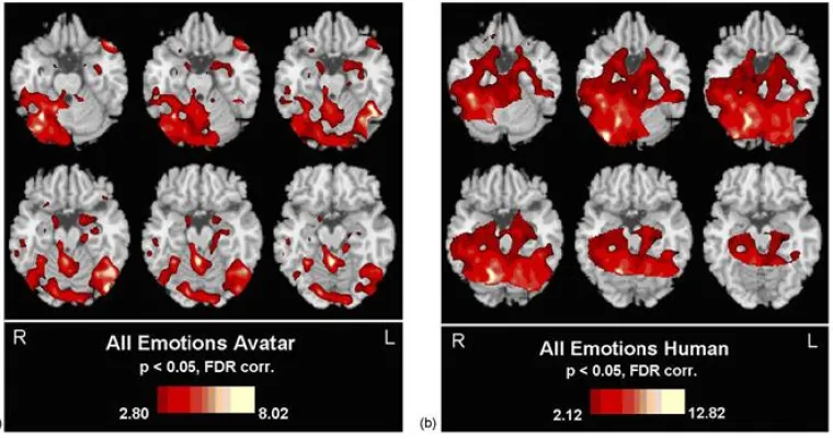 Das Gehirn vom Informationsmüll befreien Bild: Das Gehirn vom Informationsmüll befreien