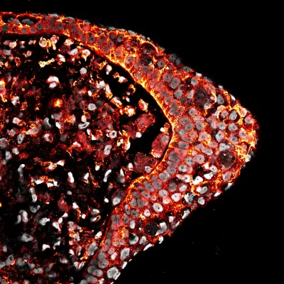 Bild: Wenn Sauerstoff bestimmt, ob eine Gliedmaße nachwächst