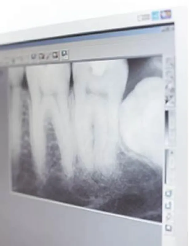 smilin??: 3-D-Entdeckungsreise im Gebiss ©smilin??