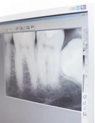 Bild: smilin’’: 3-D-Entdeckungsreise im Gebiss