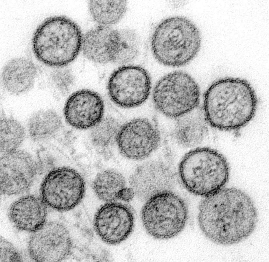 Das Sin-nombre-Virus aus der Familie der Hantaviren. Es löst unter anderem eine schwere Lungenerkrankung aus, bei der die Sterblichkeit zwischen 30-40 Prozent liegt.  (Wikipedia CDC/ Cynthia Goldsmith