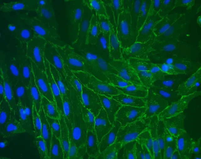 Bild: Neues Diagnosetool optimiert artfremde Organtransplantationen