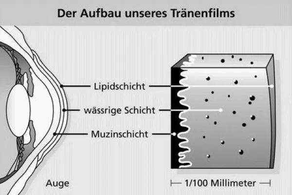 Bild: Das „Trockene Auge“ ist keine Bagatelle - Deutsche Gesundheitshilfe informiert!