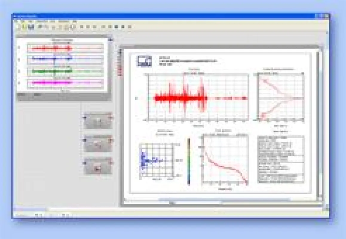 nCode GlyphXE™ ermöglicht eine einfache und klare Analyse sehr großer Datenmengen.
