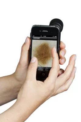 Bild: eHealth: Mobile Hautkrebsfrüherkennung jederzeit und überall