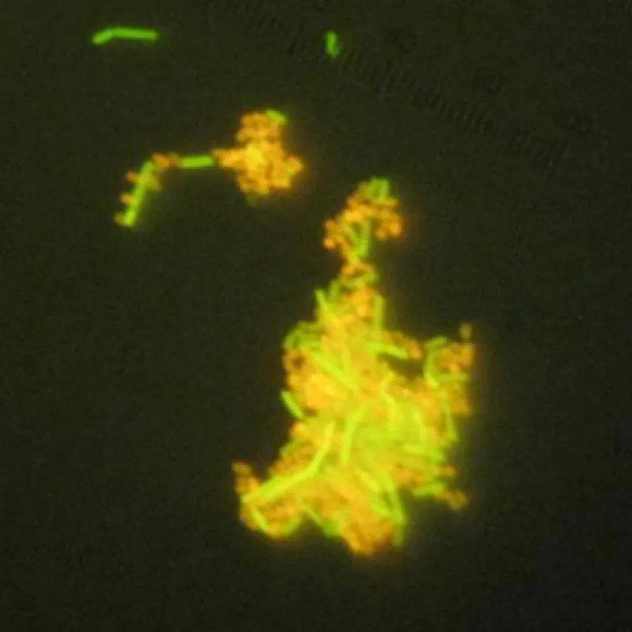 Fluoreszenzmikroskopische Aufnahme: Der Wirkstoff salvans (grün) bindet den Erkältungs-Keim (orange)