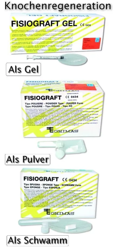 FisioGraft Knochenregenerationsmaterial am besten resorbiert