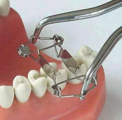 Bild: Dr. Walser Dental: Meist gelesene Veröffentlichung in Asien über Walser Matrizensystem