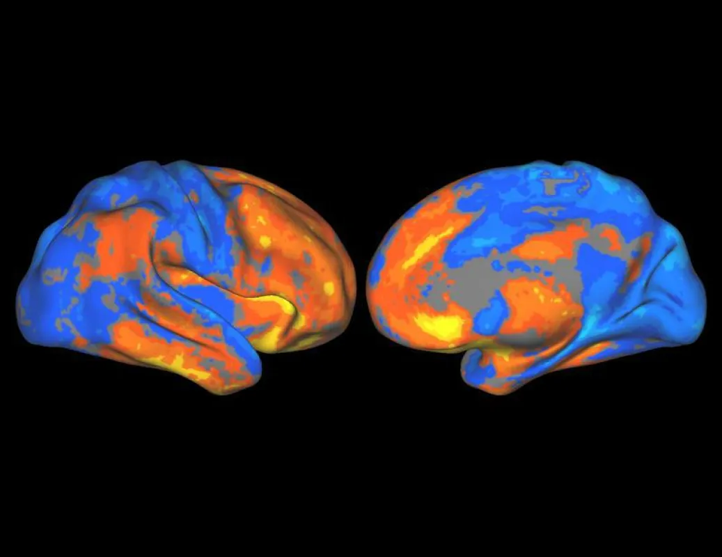 2017 wurden auch zwei TUM-Projekte aus den Neurowissenschaften mit ERC-Grants gefördert. Die Grafik zeigt, welche Hirnregionen mehr Energie benötigen, um mit anderen zu kommunizieren (orange). (PD Dr.
