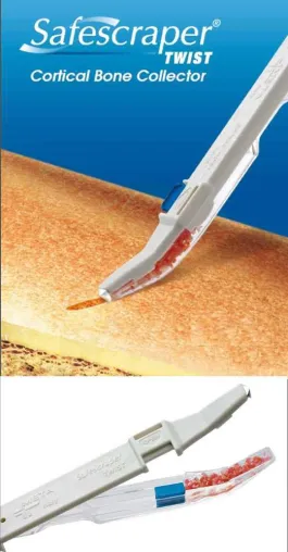 Bild: Neu bei Zantomed – Safescraper® Twist sammelt minimalinvasiv autologen Knochen