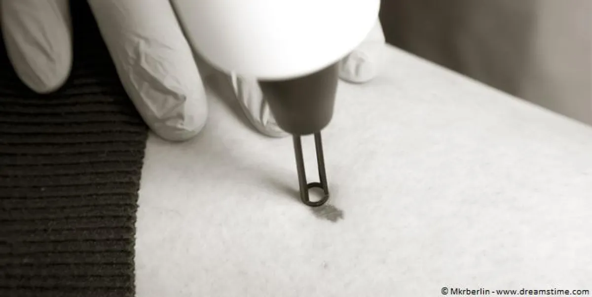 Prager & Partner: Innovative Tattooentfernung ? schonend und narbenfrei /© Mkrberlin ? www.dreamstim