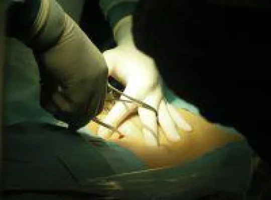 Bild: Schlüssellochchirurgie- Mit einem kleinen Schnitt viel erreichen