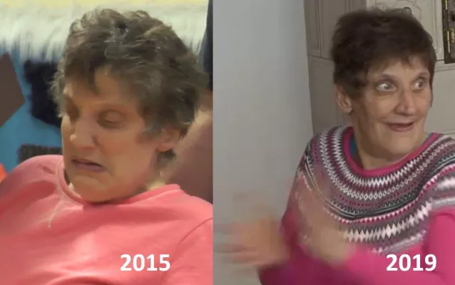 Späte Ernährungstherapie kann die Lebensqualität spät diagnostizierter PKU-Patienten verbessern Bild: Späte Ernährungstherapie kann die Lebensqualität spät diagnostizierter PKU-Patienten verbessern