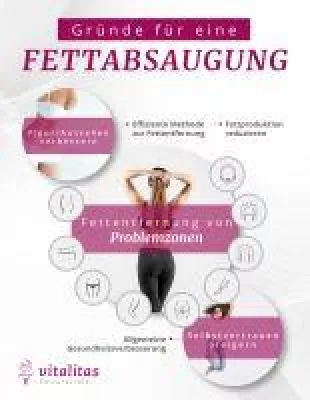 Bild: Gibt es einen Zusammenhang zwischen Fettabsaugung und Fitness?