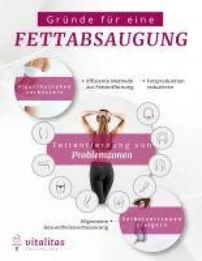 Bild: Gibt es einen Zusammenhang zwischen Fettabsaugung und Fitness?