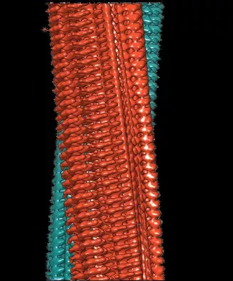 Bild: Science: Schärfstes Bild von Alzheimer-Fibrillen zeigt bislang unbekannte Details