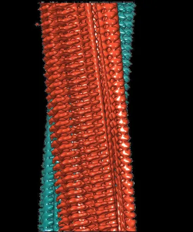 Science: Schärfstes Bild von Alzheimer-Fibrillen zeigt bislang unbekannte Details Bild: Science: Schärfstes Bild von Alzheimer-Fibrillen zeigt bislang unbekannte Details