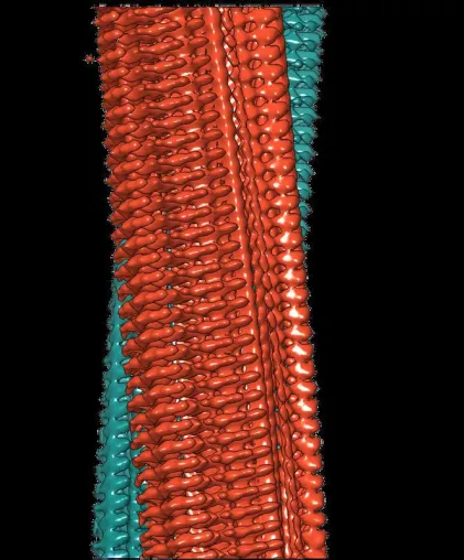Bild: Science: Schärfstes Bild von Alzheimer-Fibrillen zeigt bislang unbekannte Details