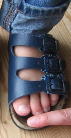 Bild: Forschung Kinderschuhe - Der Sandalen-Test