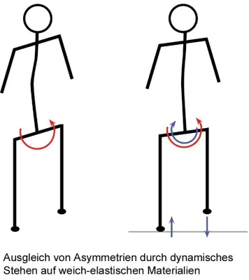 Bild: Asymmetrie des Körpers ist Ursache gesundheitlicher Probleme