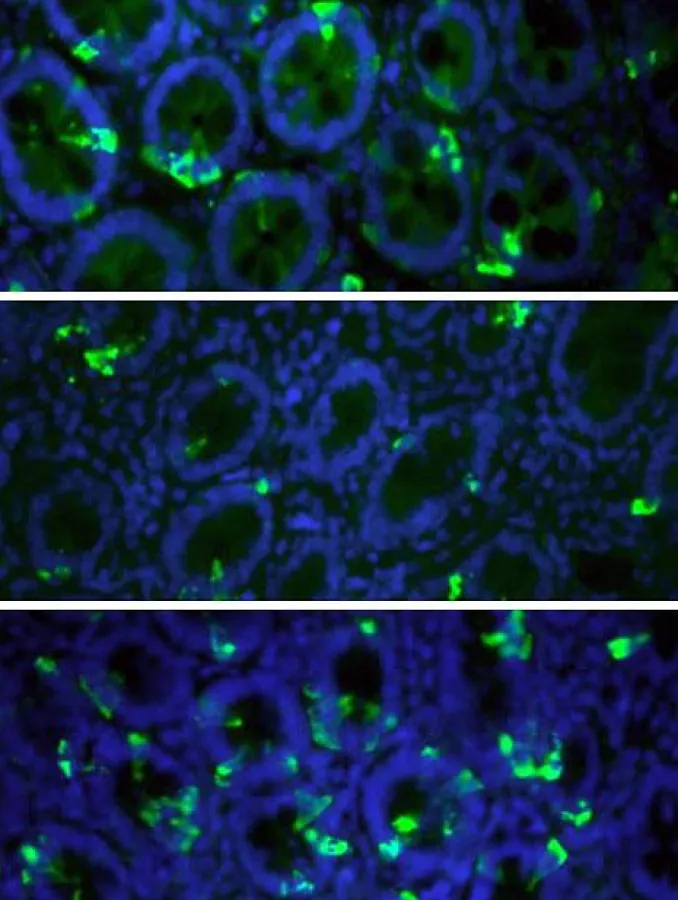 Tissue sections of the duodenum: cells which can release satiety hormones are marked in green. (University of Basel)