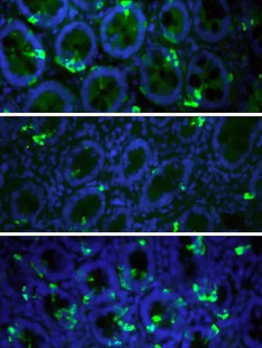 Bild: Obese People Lack Cells with Satiety Hormones
