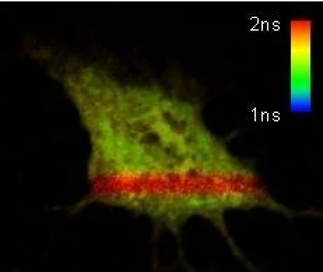 FLIM-Bild einer lebenden Zelle mit GFP/RFP-Tandem-Konstrukt. Der rote Balken wurde durch Photobleichen des Akzeptors bewirkt.