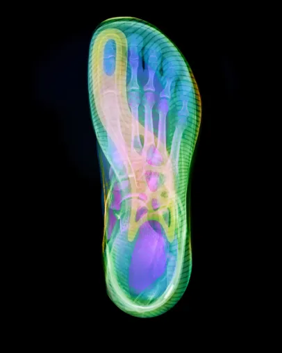 Bild: Joe Nimble revolutioniert Laufschuhtechnologie: Patent für ToePilot erteilt