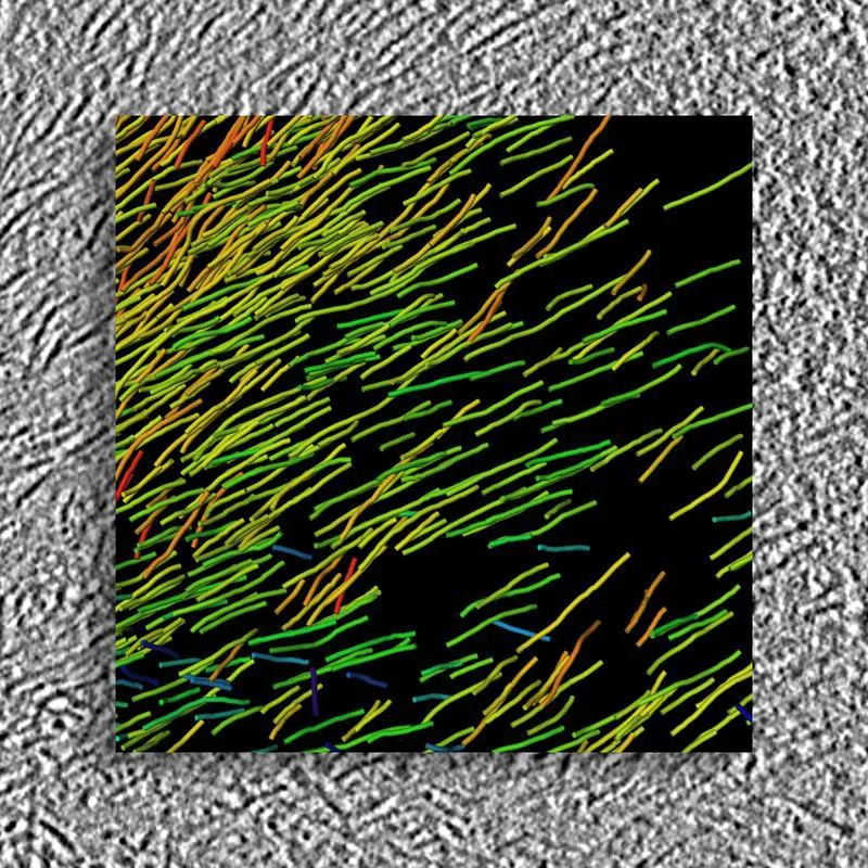 High-resolution 3D structure of huntingtin aggregates generated from cryo electon tomograms. Background: Raw data; Foreground: 3D Visualisation (© MPI für Biochemie)