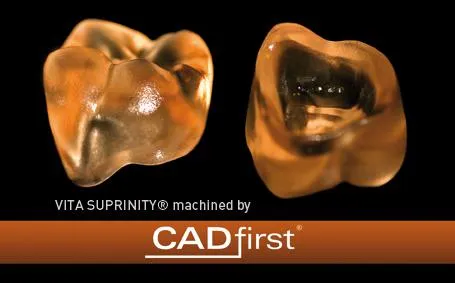 Bild: CAD/CAM Glaskeramik VITA SUPRINITY® für monolithische Versorgungen