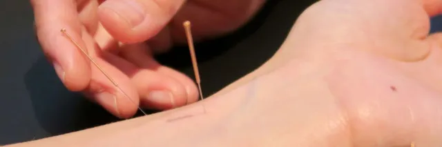 Akupunktur und Traditionelle Chinesische Medizin in Bern: Ganzheitliche Medizin im Dialog der Systeme Bild: Akupunktur und Traditionelle Chinesische Medizin in Bern: Ganzheitliche Medizin im Dialog der Systeme