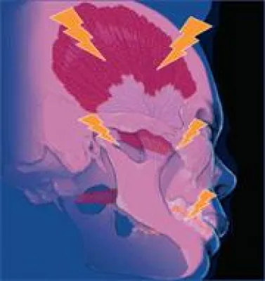 Bild: Schmerz & Bewegung: Interdisziplinärer Dialog zwischen Zahn- und Humanmedizin notwendig ?!