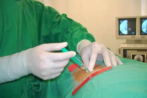 Bild: Neue Bandscheibe aus dem Labor - ADCT-Methode stellt natürliche Funktion wieder her